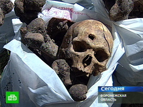 Как сделать глазной протез Как сделать глазной протез