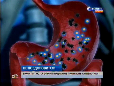 Видеоновость: Россияне выращивают в своих телах микробов-мутантов