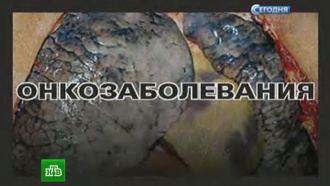 ����� ������� �&nbsp;������� ������ �&nbsp;�������� ���������� ������� �&nbsp;������� 