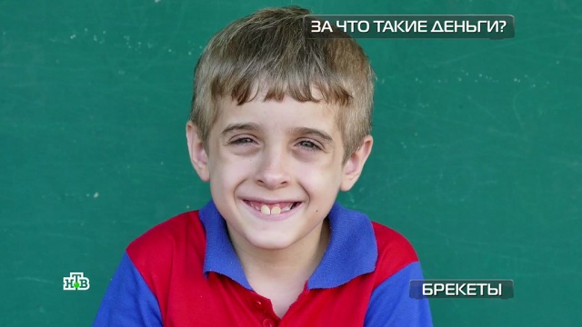 Брекеты наружные против внутренних: чего стоят комфорт и красота.
здоровье, стоматология, технологии.
НТВ.Ru: новости, видео, программы телеканала НТВ Брекеты наружные против внутренних: чего стоят комфорт и красота.
здоровье, стоматология, технологии.
НТВ.Ru: новости, видео, программы телеканала НТВ