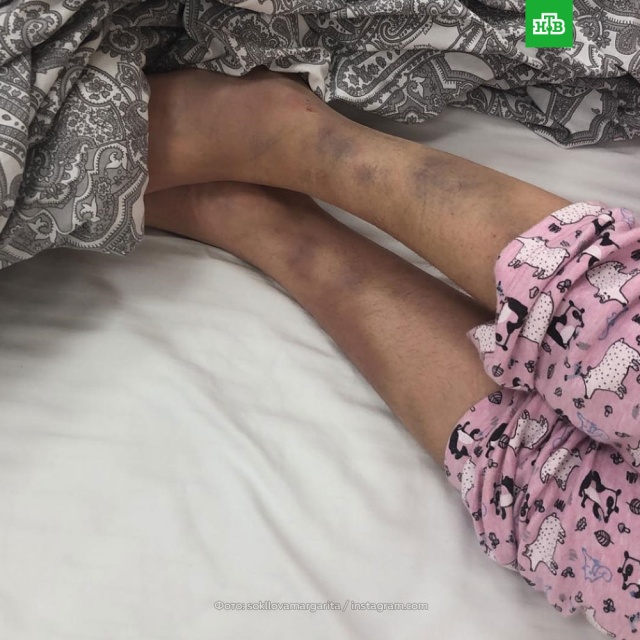 Фото разбившейся в ДТП МакSим попали в Интернет.
ДТП, музыка и музыканты.
НТВ.Ru: новости, видео, программы телеканала НТВ Фото разбившейся в ДТП МакSим попали в Интернет.
ДТП, музыка и музыканты.
НТВ.Ru: новости, видео, программы телеканала НТВ