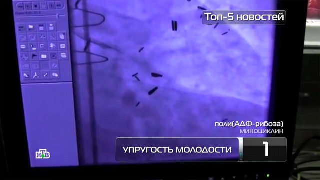 Топ-5 новостей из мира науки и технологий по версии «Чуда техники», 30 июня.
здоровье, изобретения, корабли и суда, медицина, наука и открытия, технологии, торговля.
НТВ.Ru: новости, видео, программы телеканала НТВ Топ-5 новостей из мира науки и технологий по версии «Чуда техники», 30 июня.
здоровье, изобретения, корабли и суда, медицина, наука и открытия, технологии, торговля.
НТВ.Ru: новости, видео, программы телеканала НТВ